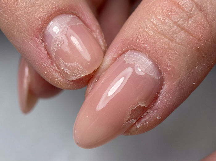 Warum halten Shellac Nägel nicht?